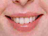 梦见牙碎了掉了什么意思(梦见牙碎成一块一块的掉了)