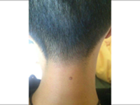 男性脖子上长痣面相图解-八字网(男性脖子上长痣好吗)