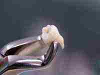 梦见蚂蟥在自己腿上脚上吸血(梦见好多蚂蟥吸在自己脚)